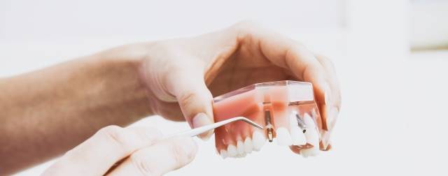 implantologia dental madrid